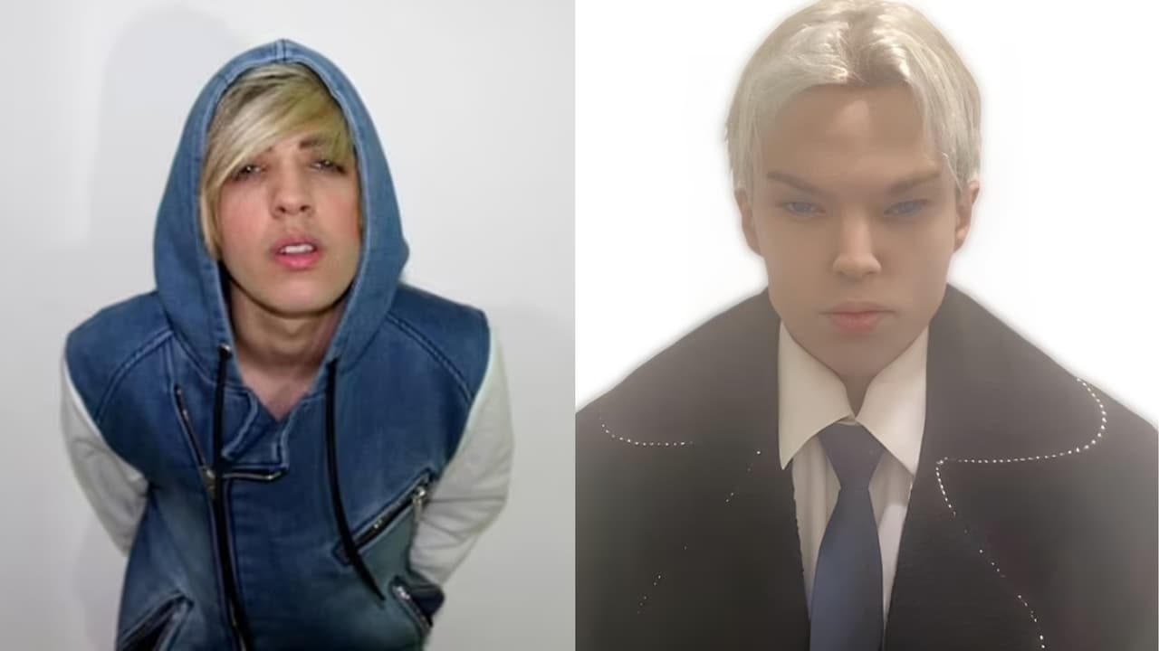 Saint Von Colucci antes y después de sus cirugías.