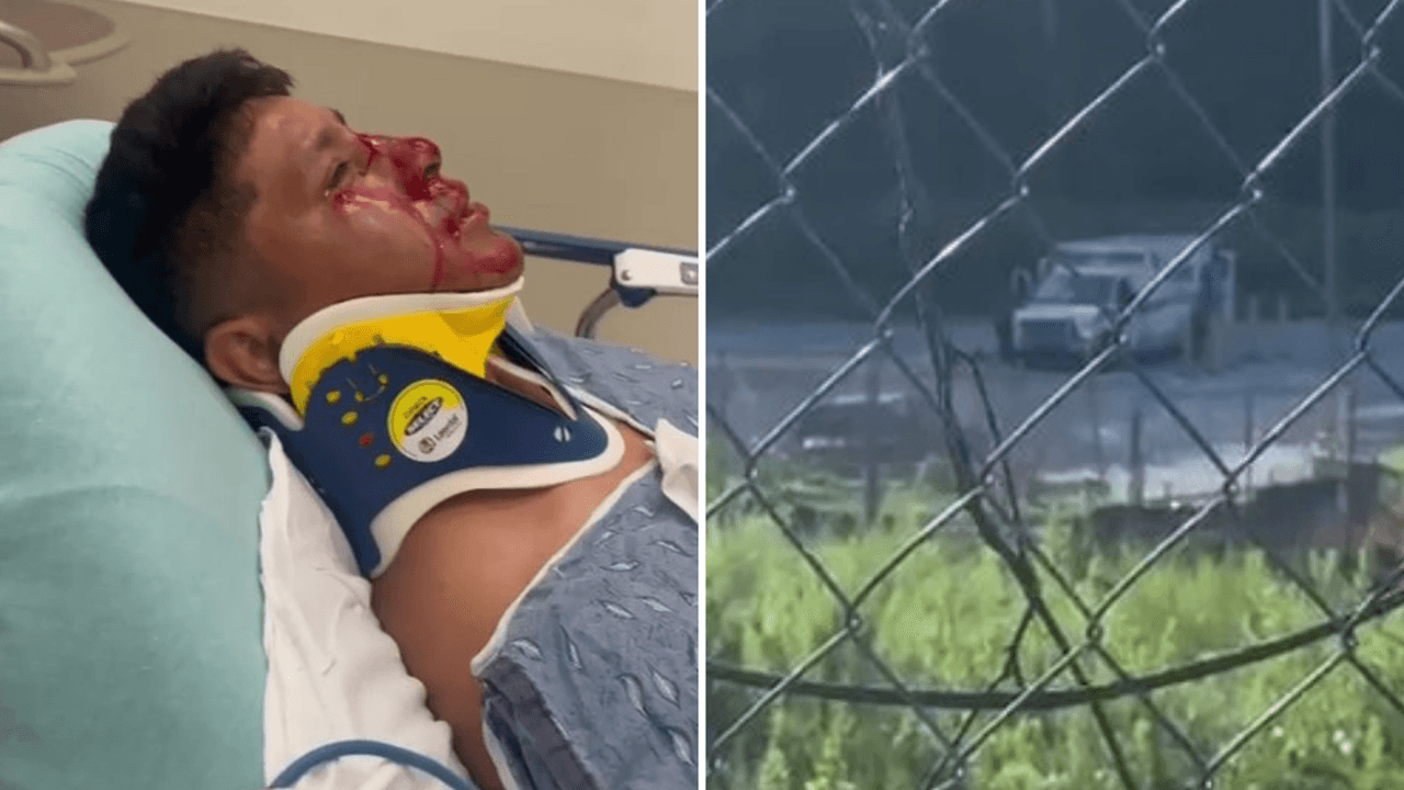 Guatemalteco resulta herido tras ser sometido por ICE con taser en gasolinera de Doraville