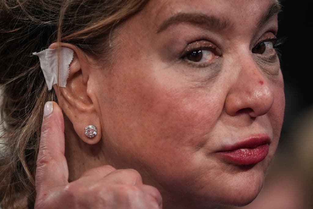 MILWAUKEE, WISCONSIN - JULY 16: An attendee points to her "bandaged" ear on the second day of the Republican National Convention at the Fiserv Forum on July 16, 2024 in Milwaukee, Wisconsin. Delegates, politicians, and the Republican faithful are in Milwaukee for the annual convention, concluding with former President Donald Trump accepting his party's presidential nomination. The RNC takes place from July 15-18. (Photo by Andrew Harnik/Getty Images)