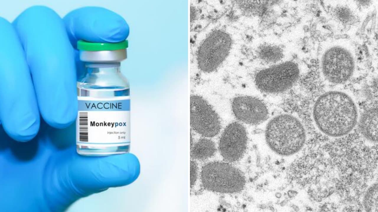 Estados Unidos suma 22 mil casos de la viruela del mono: ¿Cuántos contagios se registran en Utah?