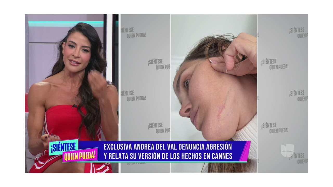 La modelo dio su versión de los hechos.