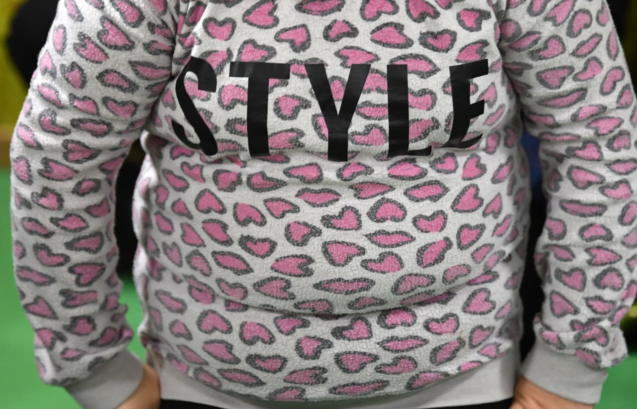 En el mundo hay diez veces más niños y jóvenes con obesidad que hace 40 años