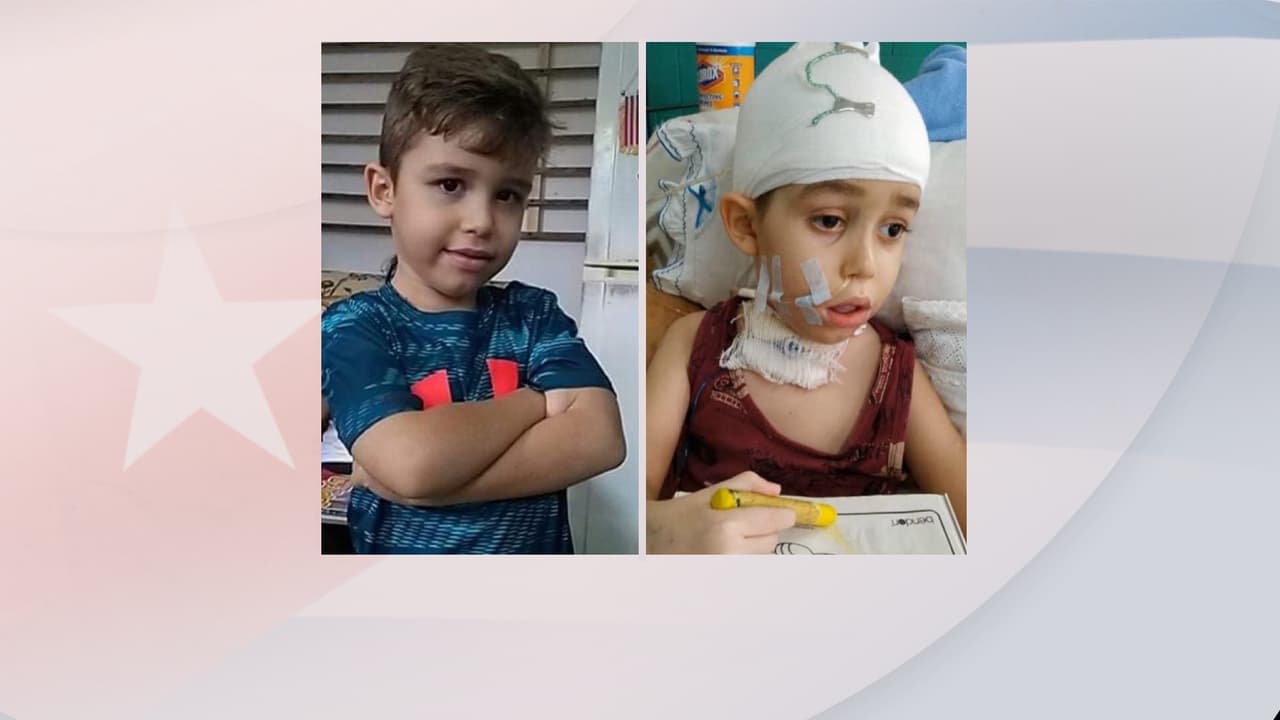 Así cambió Jhan Lucas, una vez que apareció la enfermedad en su cuerpo.