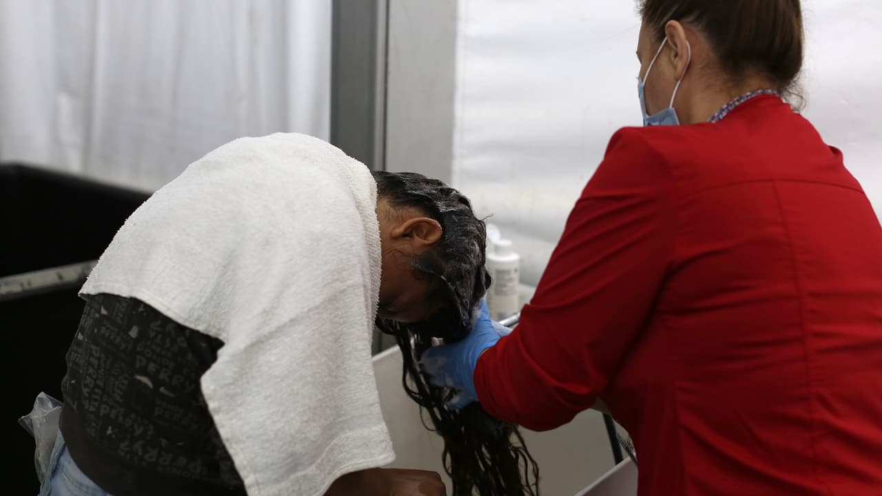 “Los piojos no respetan clases sociales, se pueden infestar desde personas muy ricas hasta las más pobres”, comentó el especialista.