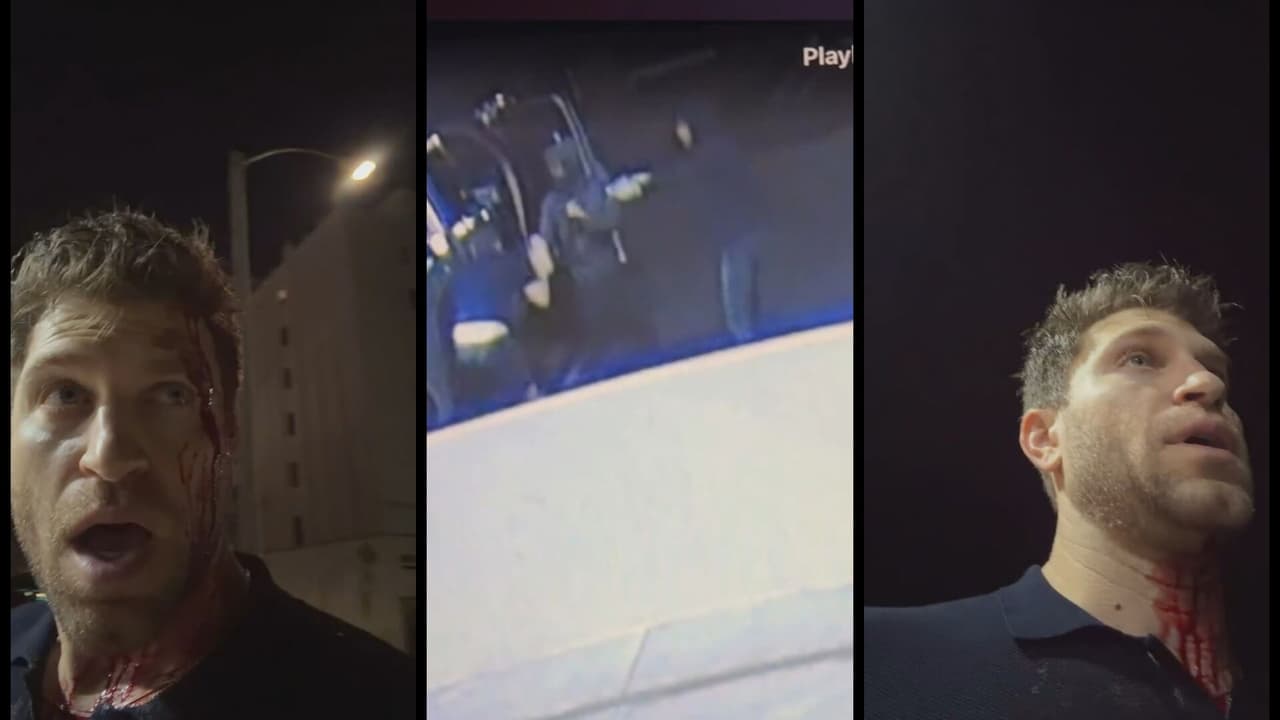 Keegan Allen, estrella de ‘Pretty Little Liars’, es asaltado a punta de pistola en West Hollywood