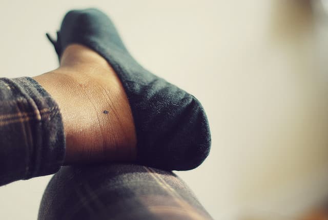 ¿Un lunar de Tatuaje?