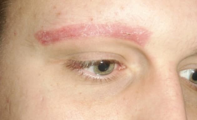 Removerse las cejas: una controvertida modificación