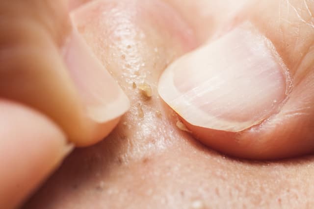 5 señales de la piel que indican problemas en el cuerpo