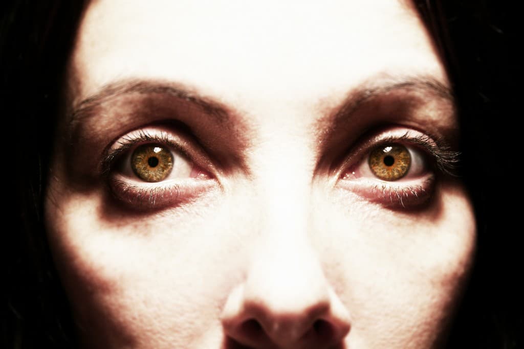 ¿Conoces estas 25 enfermedades terriblemente extrañas?