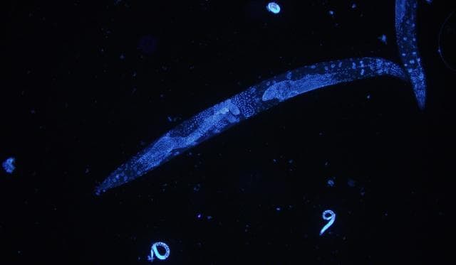El extraño esperma mortal de los gusanos nematodos