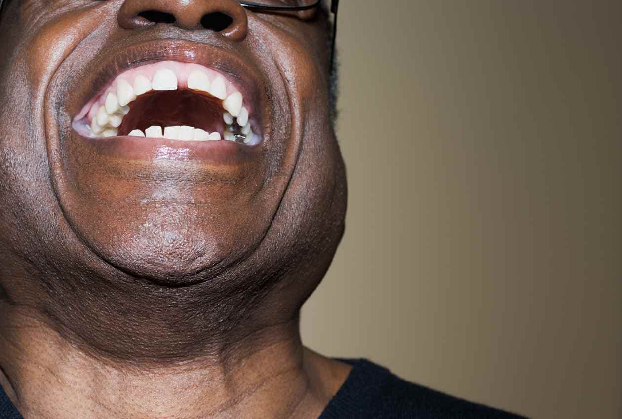 Científicos describen cuáles serían las peores y más dolorosas formas de perecer