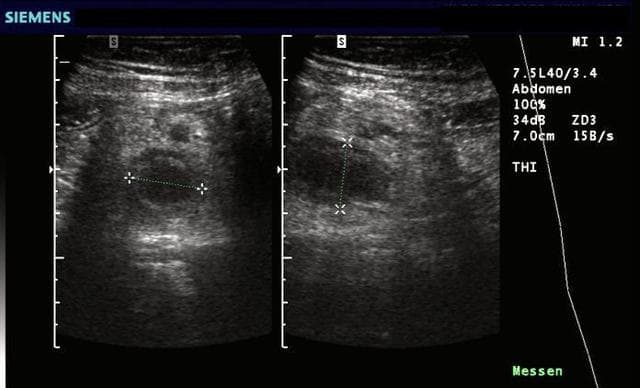 La impresionante historia de Leonid Rogozov, el hombre que se operó a si mismo