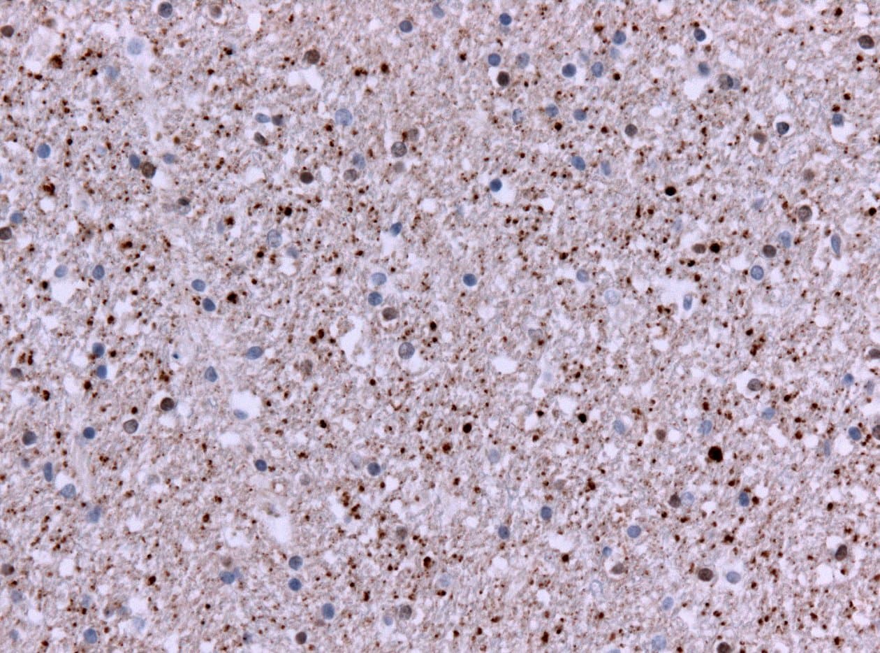 ¿Qué es el baile de San Vito?