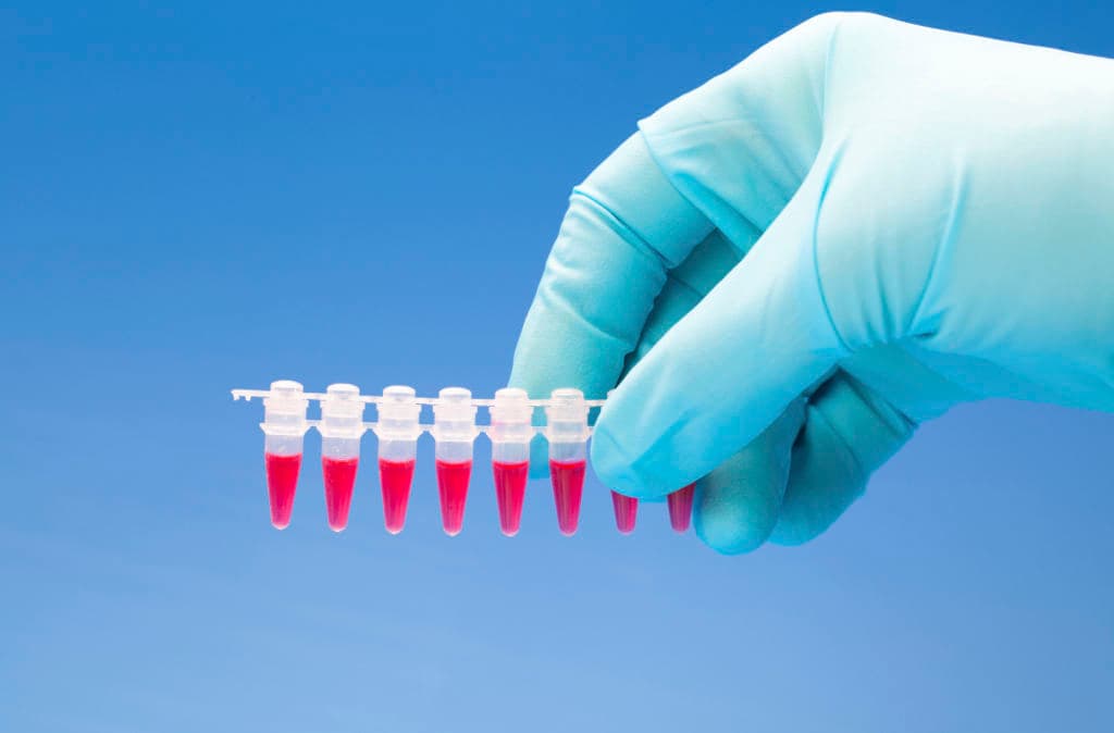 El sorprendente origen de los irlandeses, revelado por nuevas pruebas de ADN