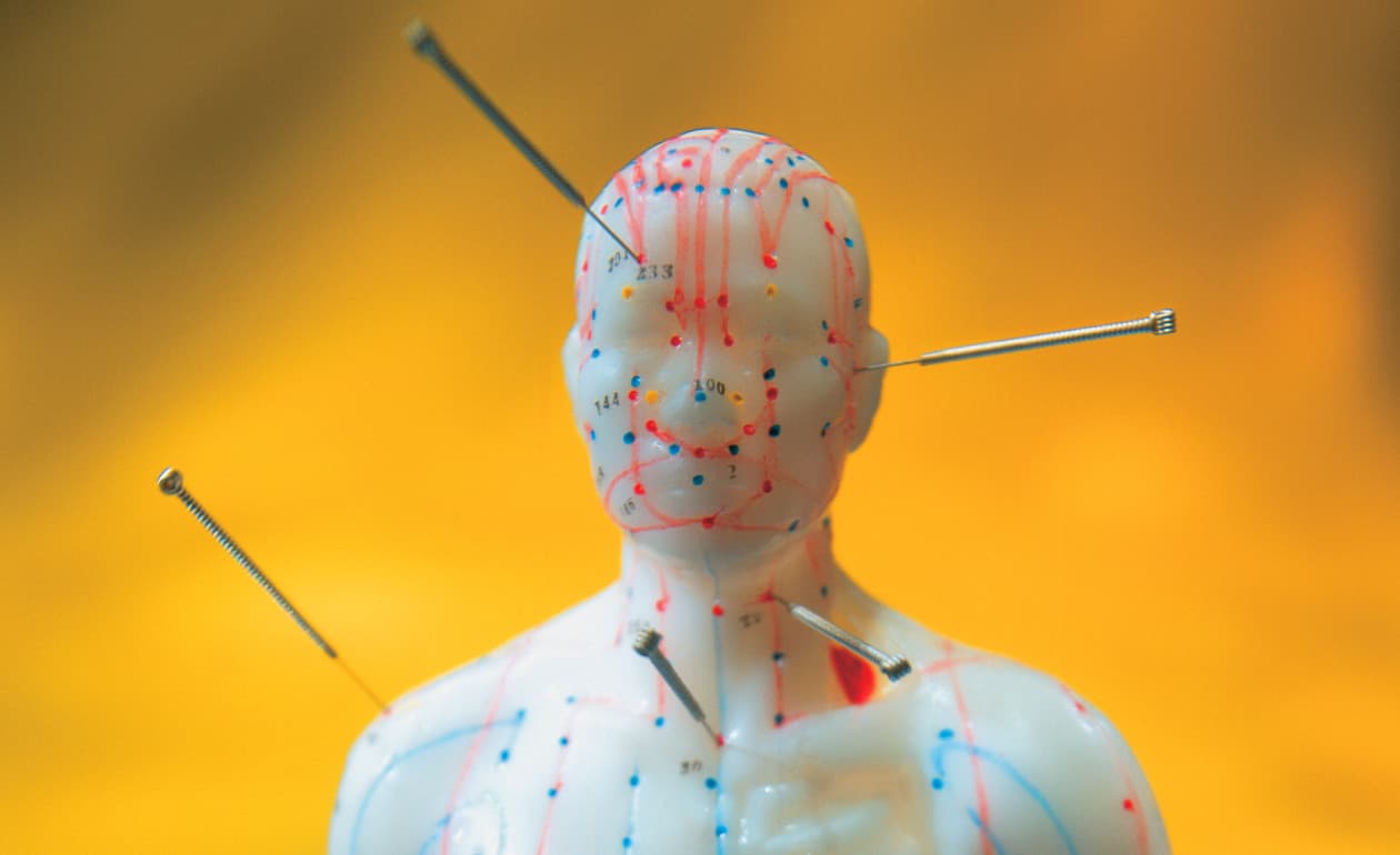 ¿Cómo funciona la acupuntura?