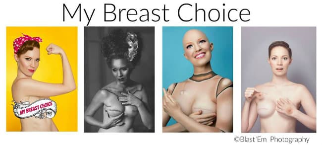 My Breast Choice, la historia de una sobreviviente al cáncer de mama narrada en imágenes