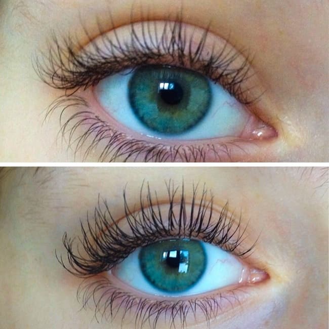 Uno de los síntomas de esta enfermedad es tener pestañas PERFECTAS