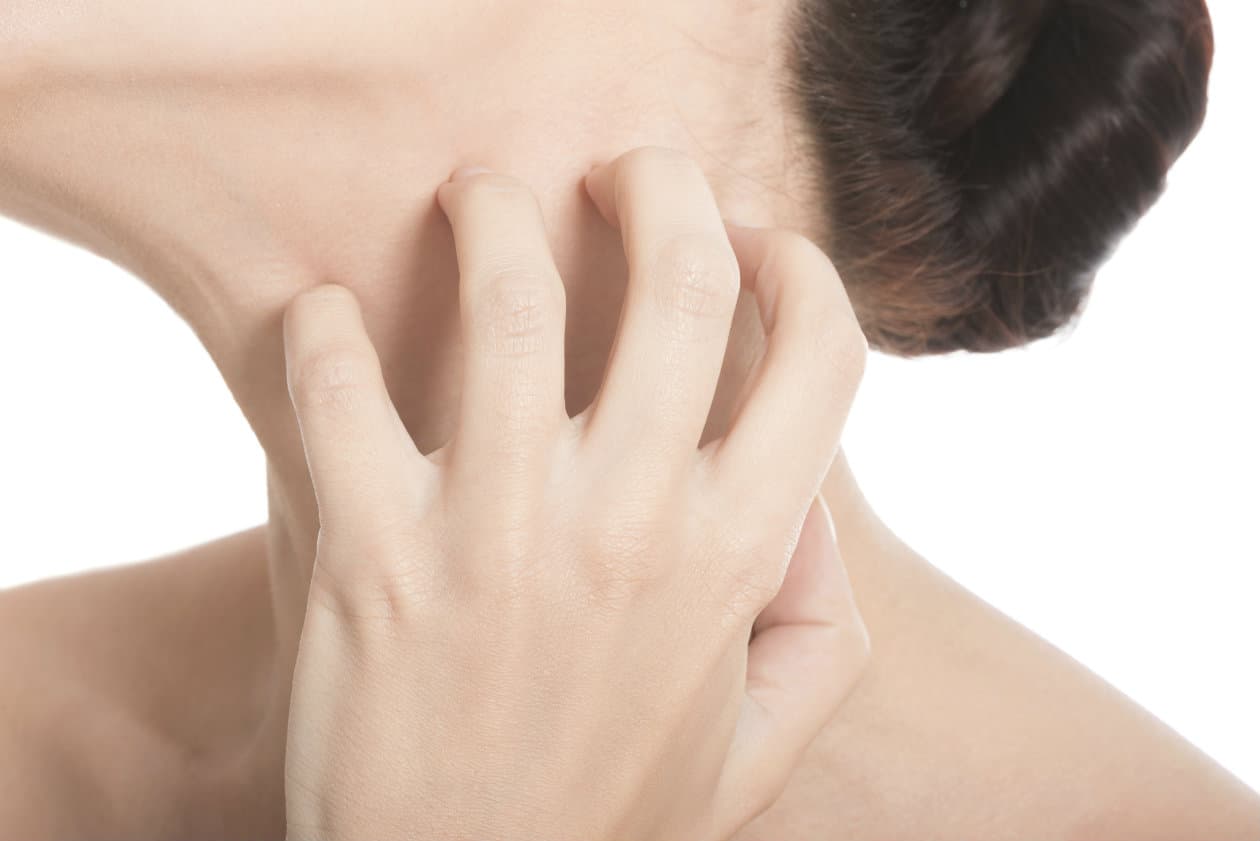 6 peligros de las cremas para blanquear la piel