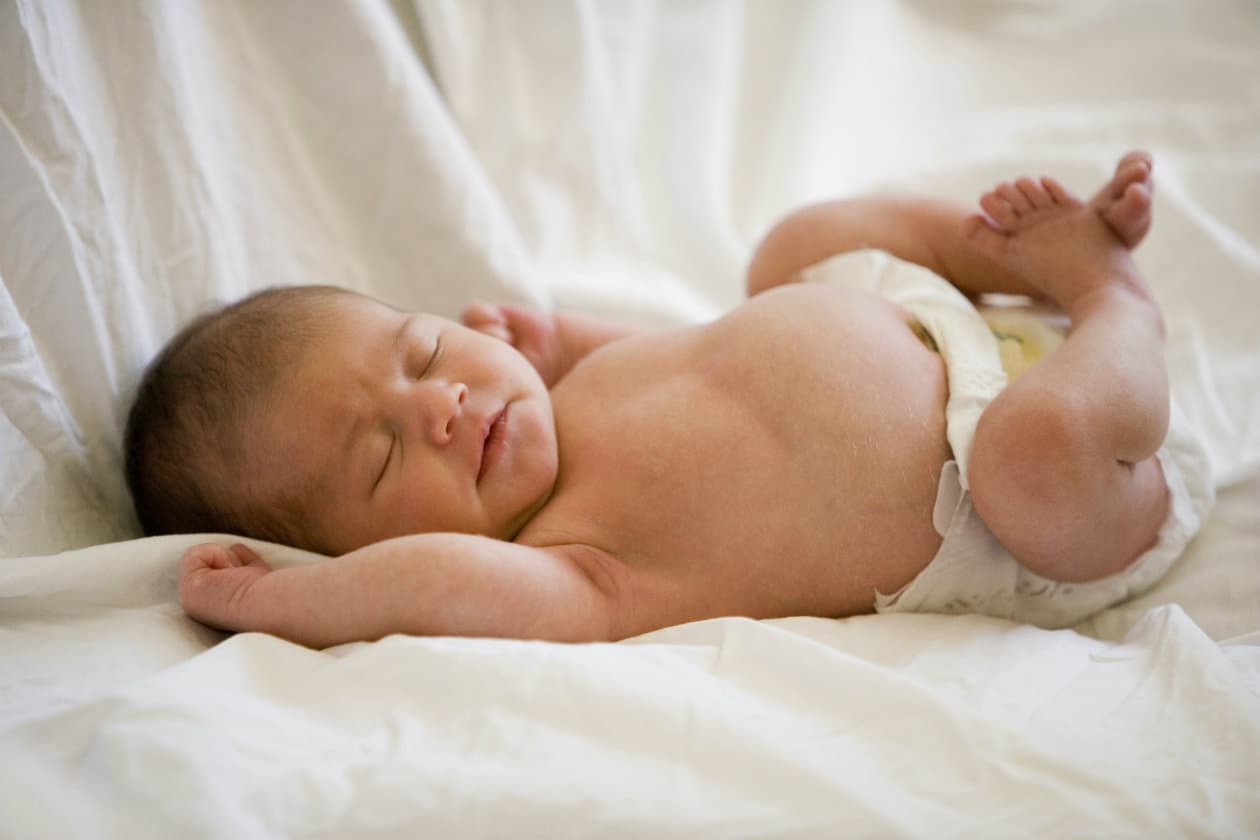 Crema para tratar el sarpullido del pañal