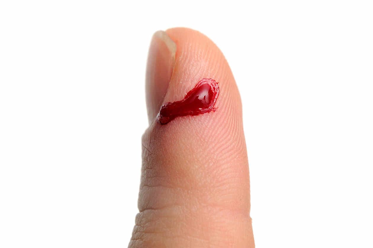 5 momentos en que la INFLAMACIÓN es la mejor amiga de tu cuerpo