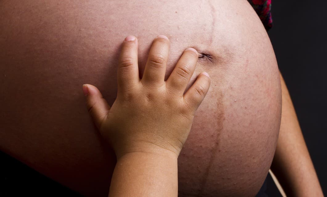 ¿Por qué salen manchas en la piel durante el embarazo?