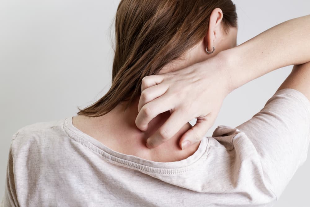 Psoriasis: qué es, cuáles son son sus causas y los 5 tipos que existen