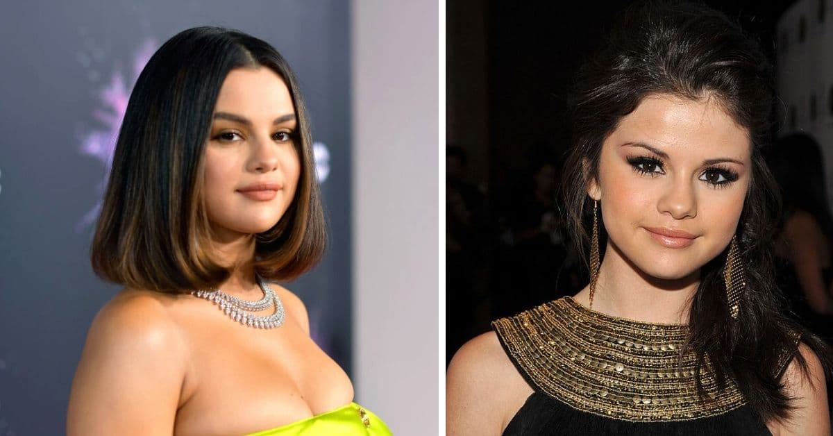 Selena Gómez mostró los estragos del lupus por primera vez y conmovió al mundo (video)