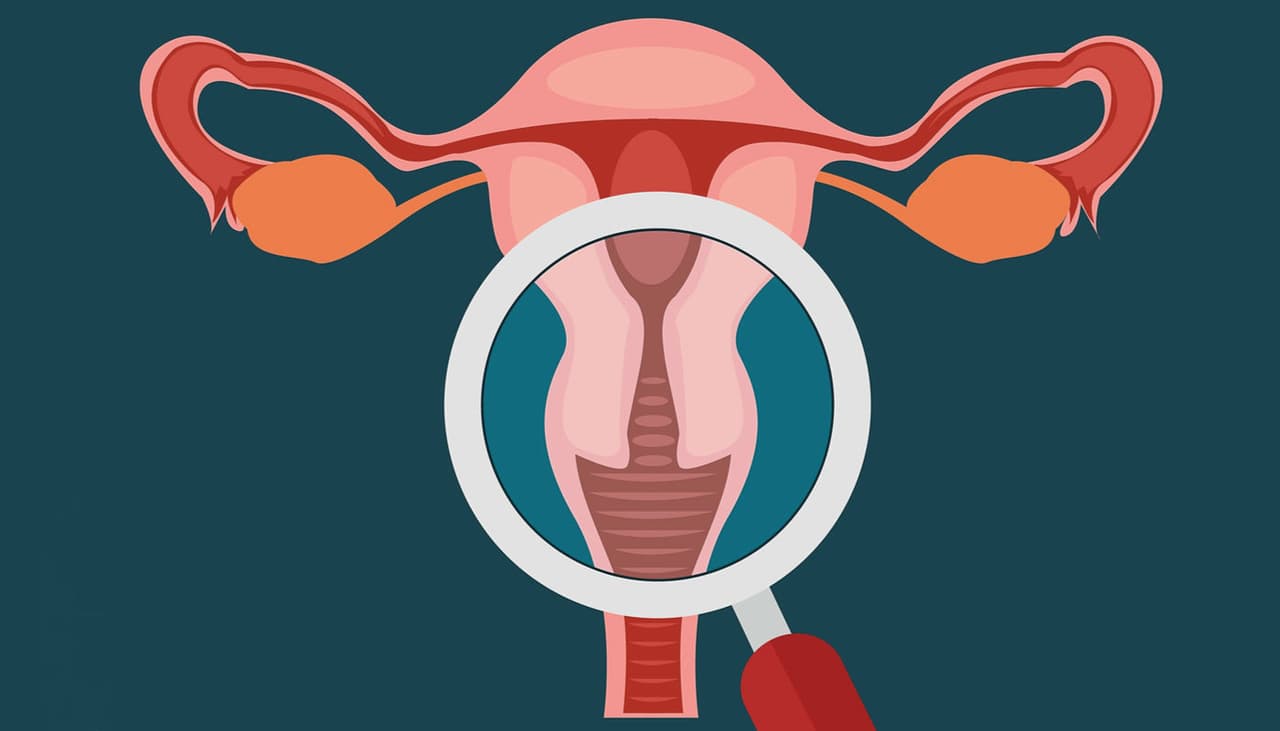 Cuello uterino bajo: cómo saber si lo tienes y cómo afecta tu salud