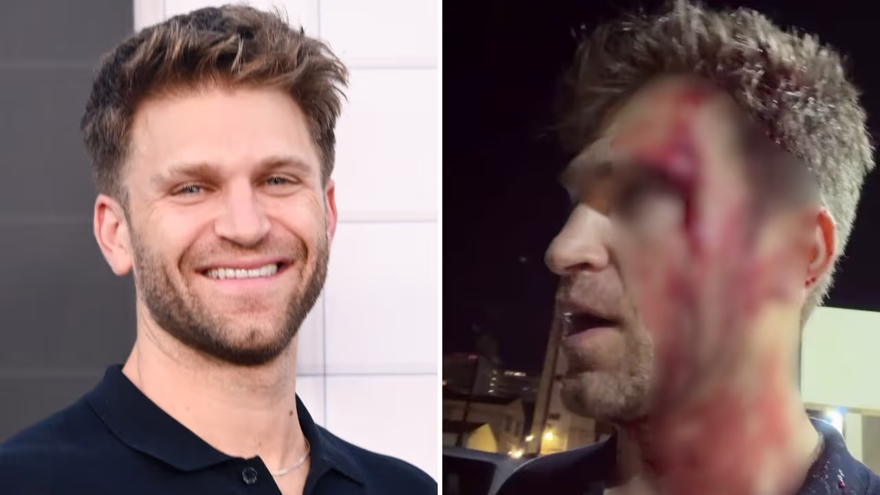 Actor de ‘Pretty Little Liars’ es asaltado a punta de pistola y termina gravemente herido