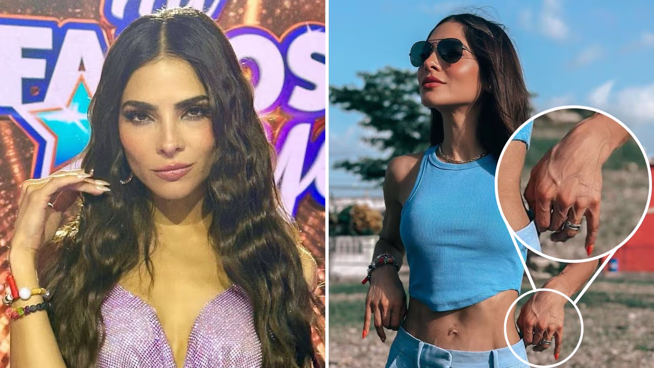 Alejandra Espinoza revela qué hay detrás de que tenga “tantas venas en las  manos” | Univision Famosos | Univision