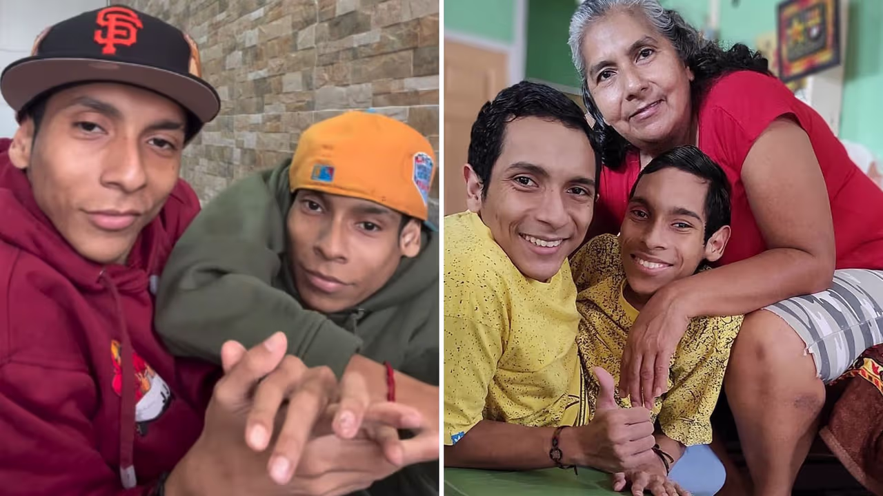 Papás de los ‘Siameses del Ecuador’ están “devastados” tras su muerte y siguen sin poder despedirlos