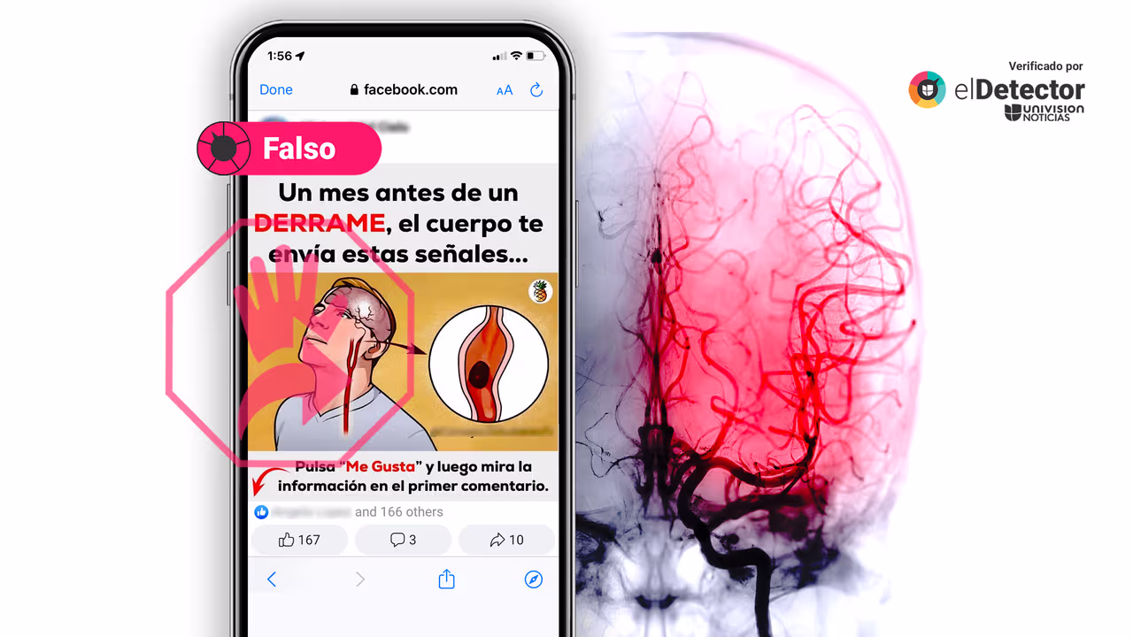 Image accompanying Un mes antes de sufrir un derrame cerebral, el cuerpo envía una serie de señales.