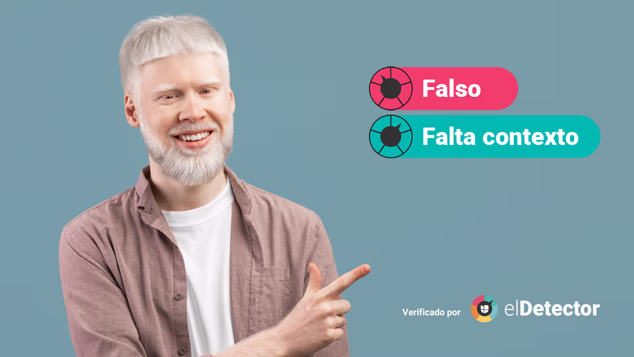 Image accompanying ¿El albinismo es contagioso?
