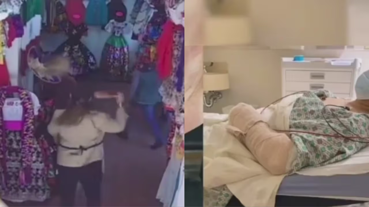 El ataque a una mujer de la tercera edad con un bate de béisbol en ...