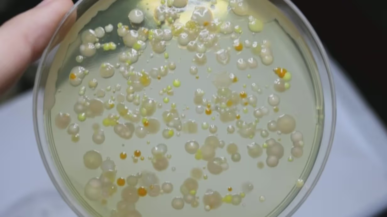 Ameba comecerebros: síntomas de un contagio con esta peligrosa bacteria ...