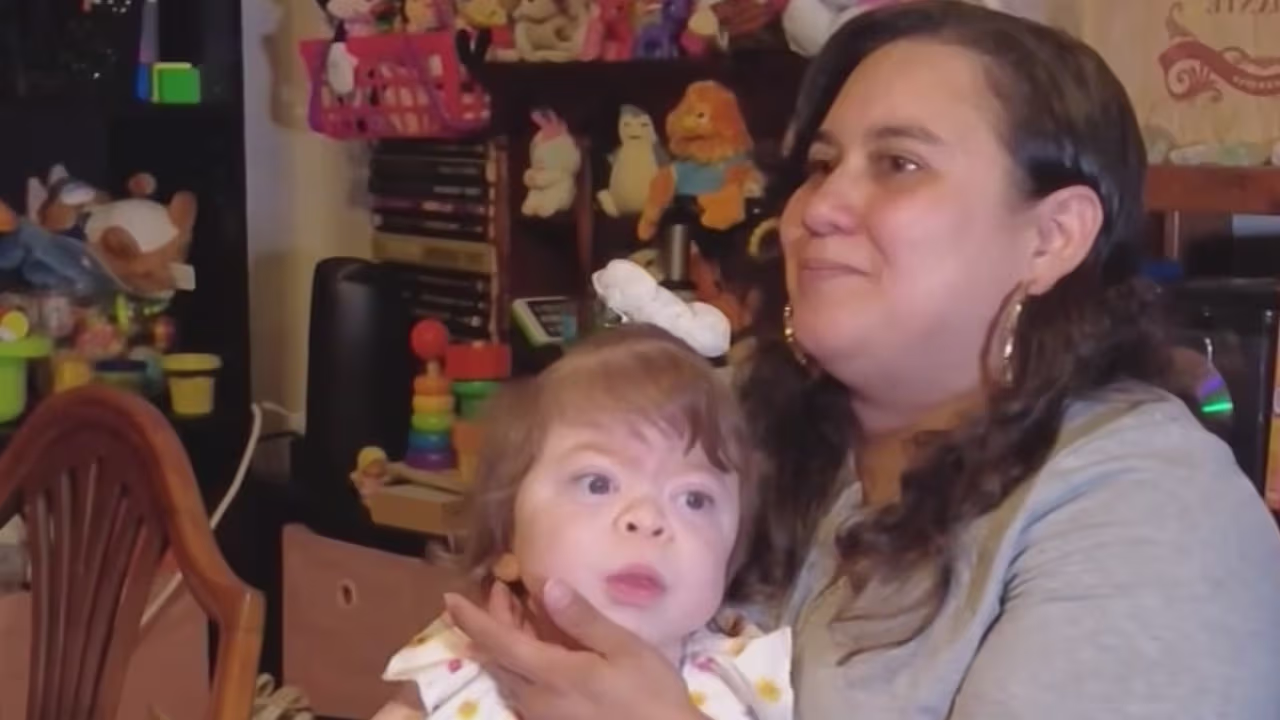 Niña de 3 años con rara condición genética necesita ayuda para recibir ...
