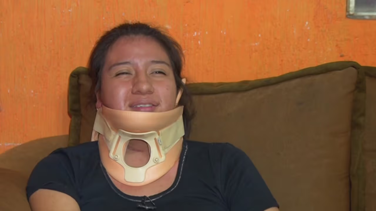 Mujer vive con una bala en su cuello: busca ayuda para que un médico ...